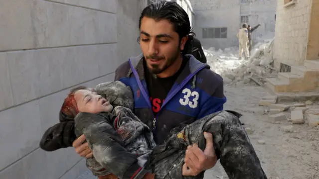 Спасатель несет раненого мальчика в Алеппо