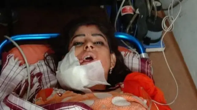 ઇજાગ્રસ્ત મહિલા