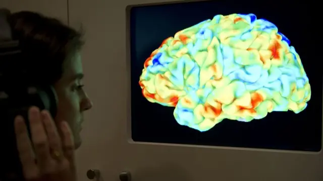 การตรวจสมองด้วยเครื่องสนามแม่เหล็กแรงสูง