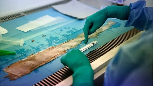 నిల్వ చేసిన చర్మం