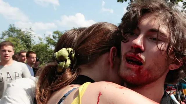 Следы побоев