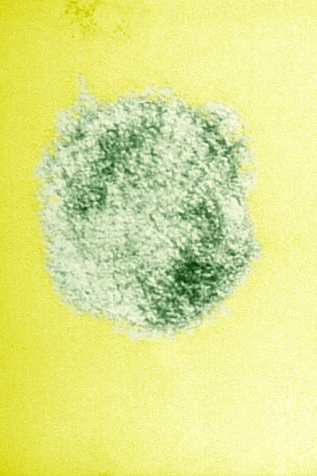 హంటావైరస్