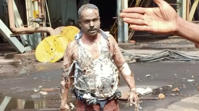 நெய்வேலி அனல் மின் நிலைய விபத்து