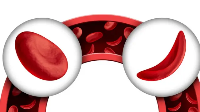 Glóbulos rojos