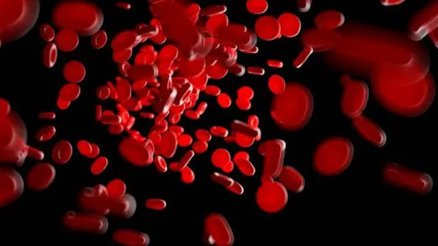 एनीमिया