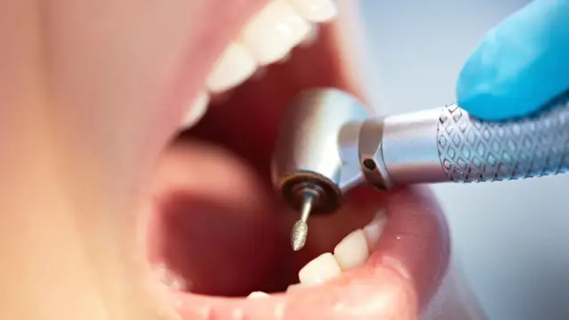Dentist using drill in patient's open mouth