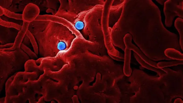 মার্সের জন্য দায়ী এই করোনাভাইরাস।