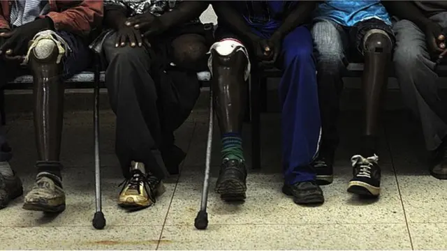 2009년 3월 25일 앙골라 후암보에 있는 아고스티노 네토 정형외과 센터 병동에서 지뢰 피해자들이 물리 치료를 시작하기 위해 기다리고 있다.