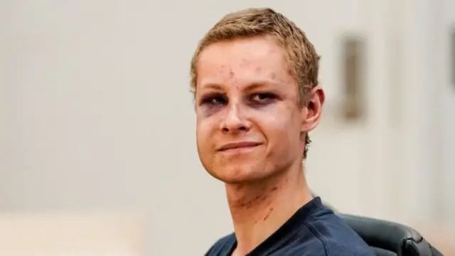 On 12 August Manshaus appeared in court with bruises and scratches on his face