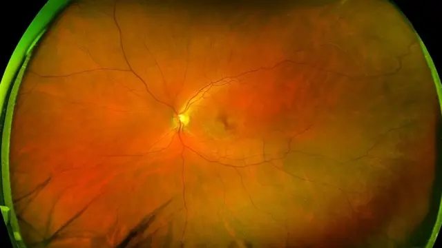 علامات تحذير خفية "تتنبأ بصحتك" في المستقبل