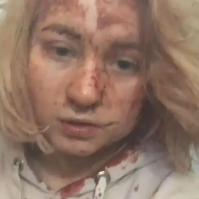 Perang Ukraina, Chernihiv