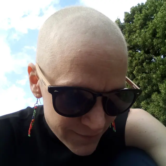 Primer plano de Kristina Svensson durante el tratamiento de quimioterapia