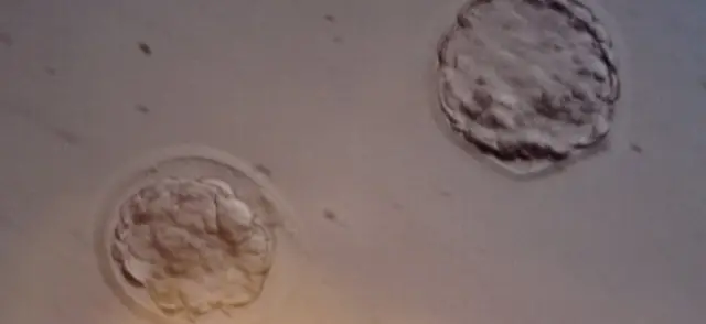 Embriones donados por Andy y Shannon Weber