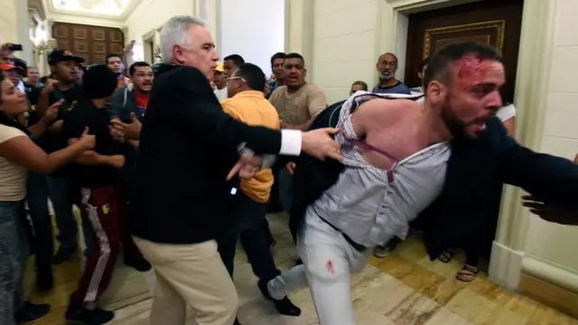 Una persona con una herida en la cabeza en el palacio legislativo