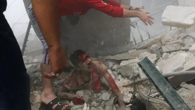 طفل سوري جريح