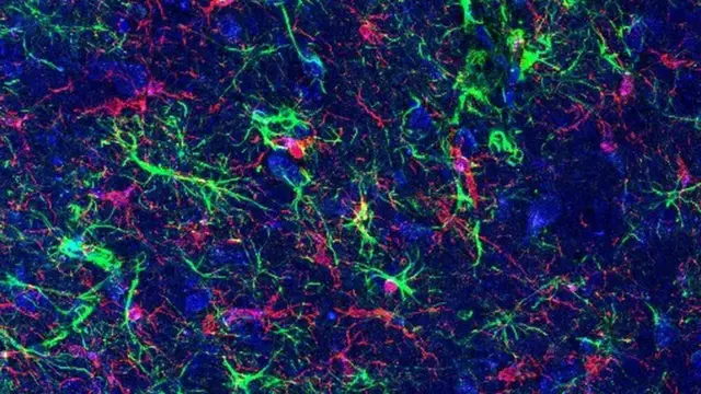 بكتريا الأمعاء قد تكون سببا رئيسيا في مرض باركنسون