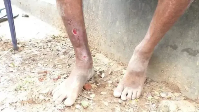 கிராமத்தை தாக்கும் சிவப்பு எறும்பு படை