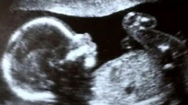 विज्ञान, आरोग्य, गर्भाशय, महिला आरोग्य