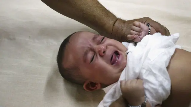 Bebê sendo circuncidado