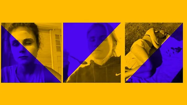 वो बीमारी जिसमें जागते हुए नींद के दौरे पड़ते हैं