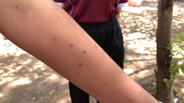 रिया घाटघरे, मधमाशा हल्ला, पर्यावरण