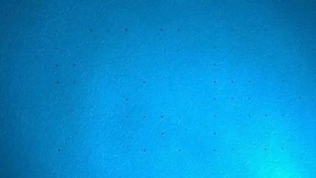 Мікрокрапки