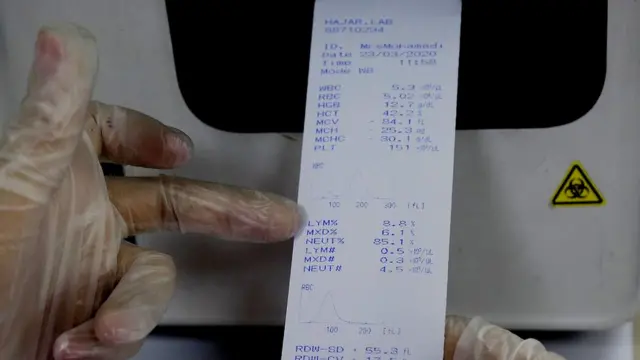 آزمایشگاه کرونا در ایران