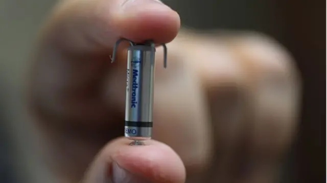 El marcapasos más pequeño del mundo.