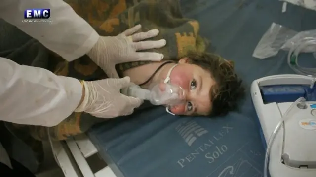 تصویری از یک کودک که در حال دریافت تنفس مصنوعی است