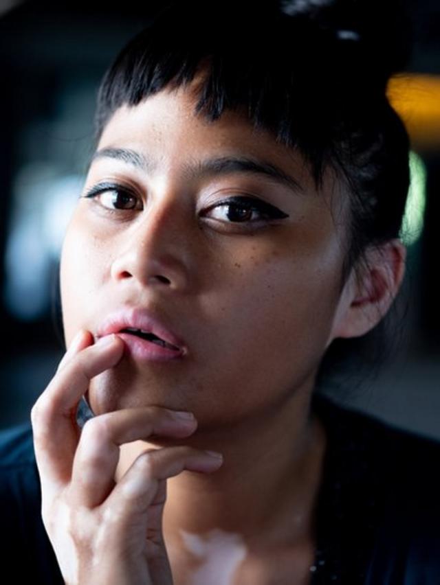 Malaysian photographer takes self portrait of her vitiligo