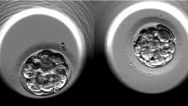 La division cellulaire observée par microscope