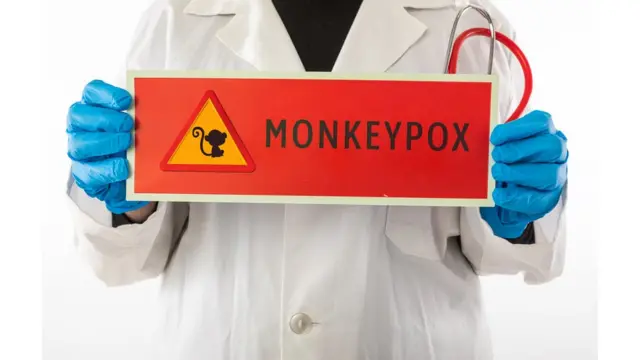 குரங்கம்மை