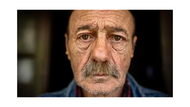 Les rides de la peau peuvent également être à l'origine du vieillissement