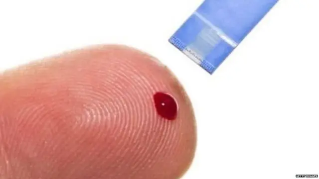 ਡਾਈਬਿਟੀਜ਼