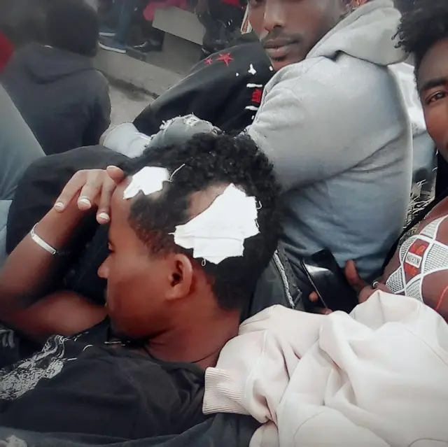 ኣብ ዩኒቨርሲቲ ደብረብርሃን ተወቒዑ ጉድኣት ዝበጸዕሖ ተምሃራይ