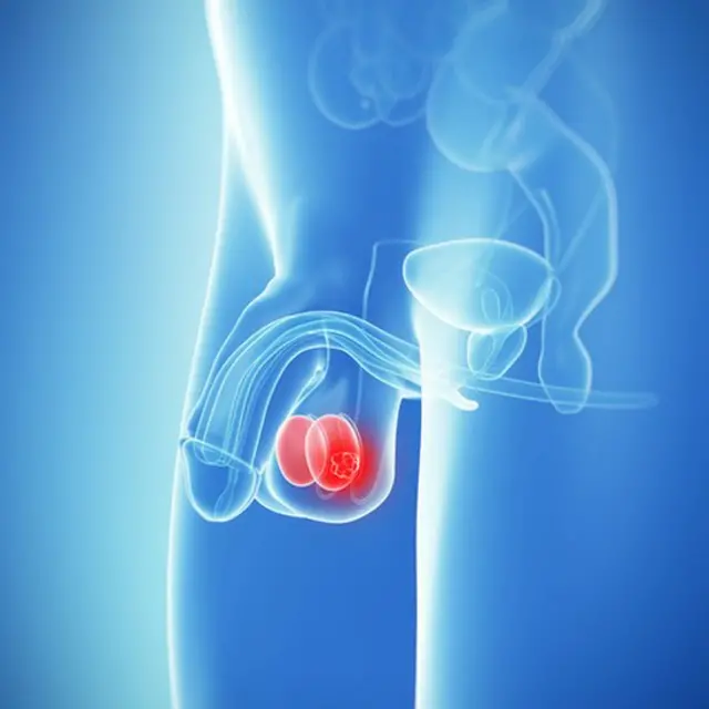 पुरुष, आरोग्य, वंध्यत्व, लिंग