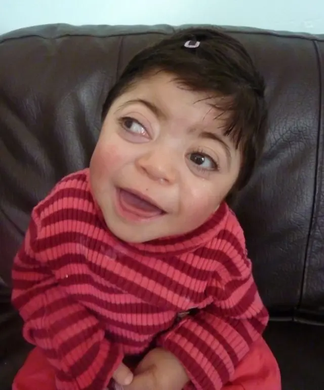 طفلة نتيجة زواج الأقارب في بريطانيا