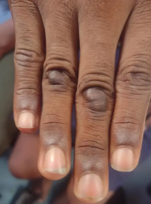 एक बच्चे की उंगलियां