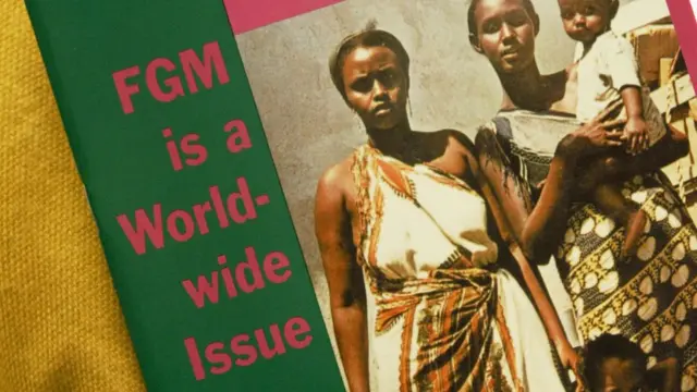 FGM