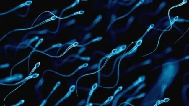 શુક્રાણુની તસવીર