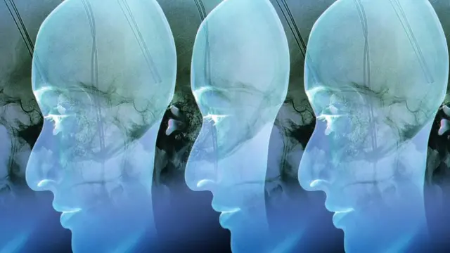 Ilustración de una cabeza duplicada.