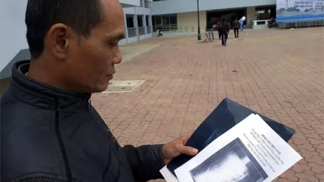 Ma Van Nhat con la radiografía donde aparecen las tijeras