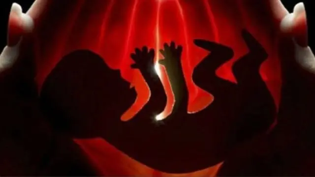 Sri Lankan Abortion Law