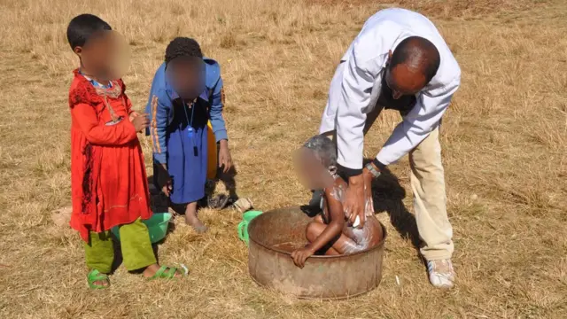 Nepara guruhining etakchi xonandasi yalangoch, fotosuratlarga qarang. Jinsiy olat spermani sekin otadi