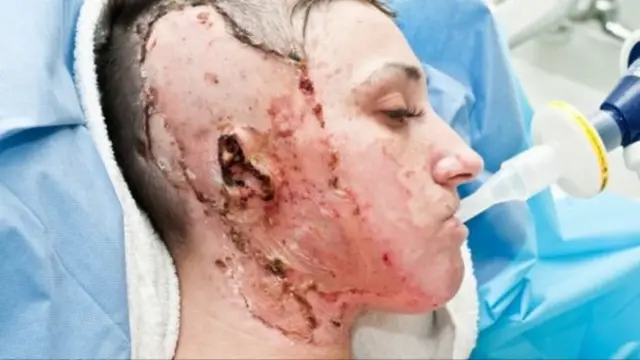 Шрами Адель