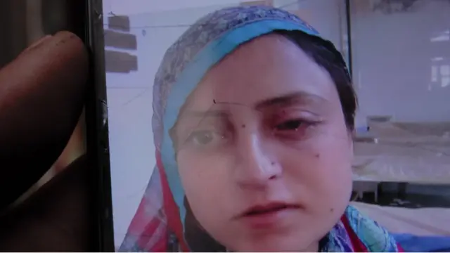 कश्मीर: 'उस पैलेट गन ने मेरे ज़िंदगी बर्बाद कर दी'