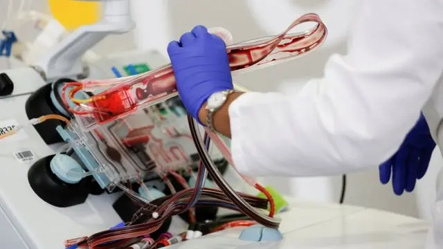 در روش جدید پلاسمای خون کسانی که پیشتر دچار بیماری کوید - ۱۹ شده بودند برای کمک به درمان بیماران استفاده می‌شود