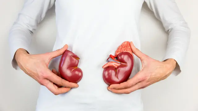 Una mujer a la que no se le ve la cara sostiene dos riñones de plástico