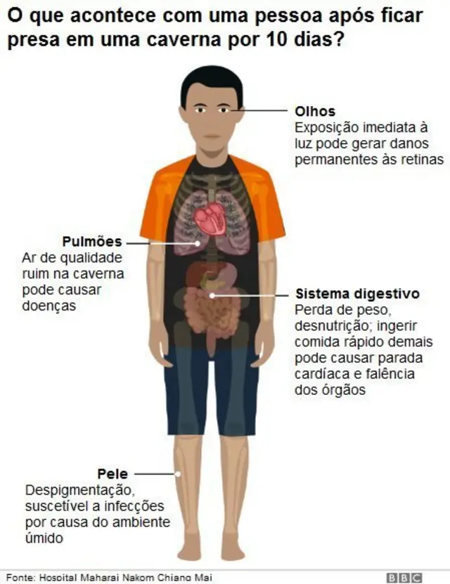 Ilustração do corpocaça níquel de futebolum menino, mostrando o que acontece com uma pessoa após ficar presacaça níquel de futeboluma caverna por 10 dias - olhos: exposição imediata à luz pode gerar danos às retinas; pulmões: arcaça níquel de futebolqualidade ruim na caverna pode causar doenças; sistema digestivo: perdacaça níquel de futebolpeso, desnutrição; pele: despigmentação suscetível a infecções por causa do ambiente úmido