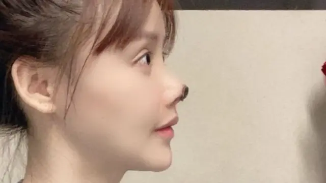 சீனா அழகு பிளாஸ்டிக் சர்ஜரி